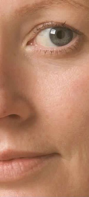 After image of an Oxygen Therapy session