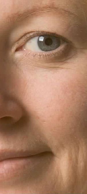 Before image of an Oxygen Therapy session